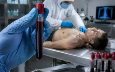 El monóxido de carbono puede investigarse después de la muerte mediante un marcador específico en la sangre